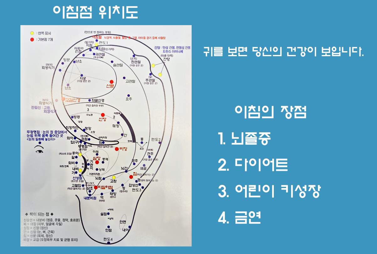 이혈 테라피 (귀로 보는 건강) 썸네일